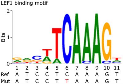 Functional analysis of CTLA4 promoter variant and its possible implication in colorectal cancer immunotherapy